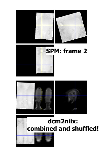 spm_vs_dcm2niix_001